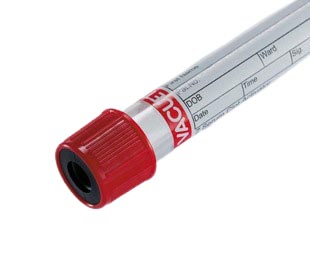 Z Serum 4,5 ml ohne Gel, rote Ka