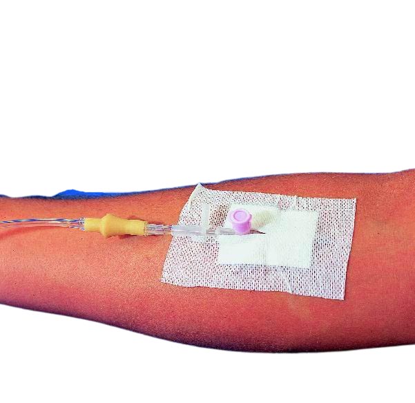 Kanülenfixierung Askina soft I.V. ster